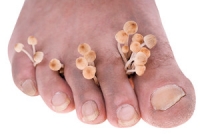 How to Know If You Have Toenail Fungus