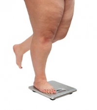 The Connection Between Obesity, RA, and the Health of Your Feet