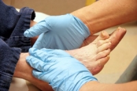 The Importance of Foot Inspections for Diabetics